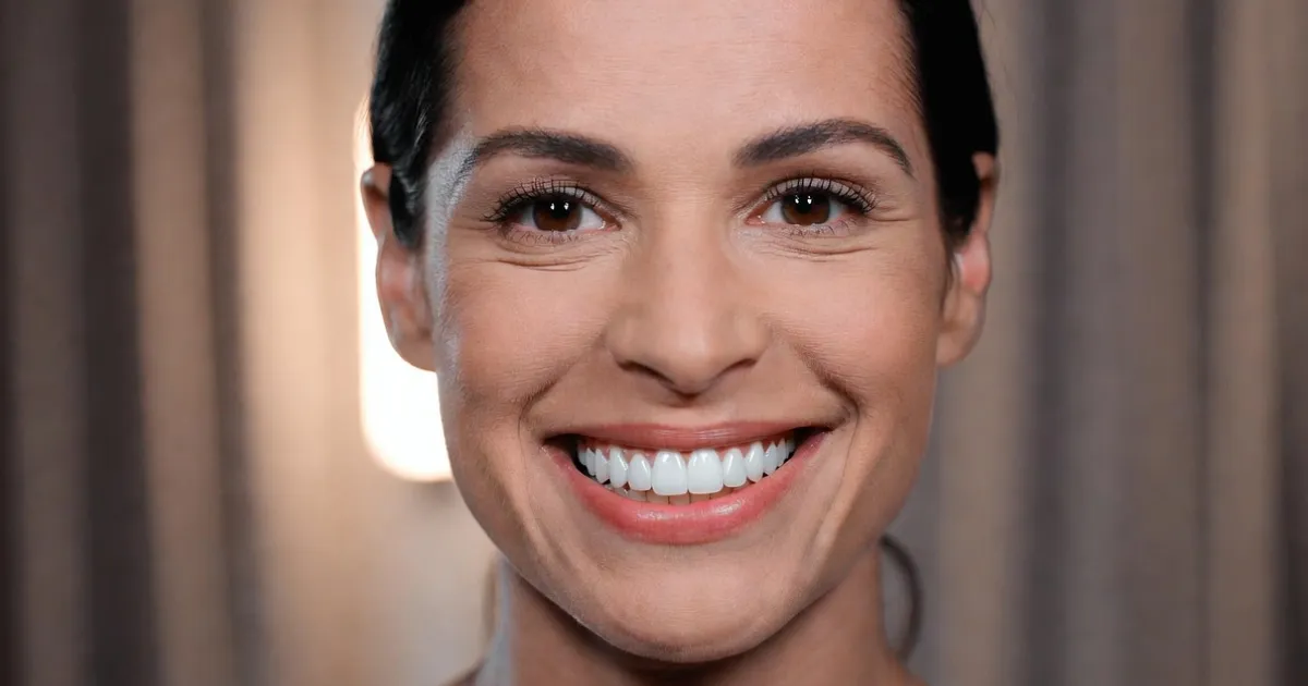 veneers teeth celebrity